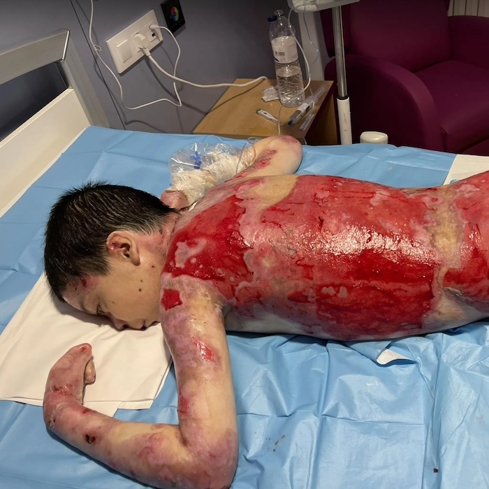 Jesus receiving wound care in a hospital bed