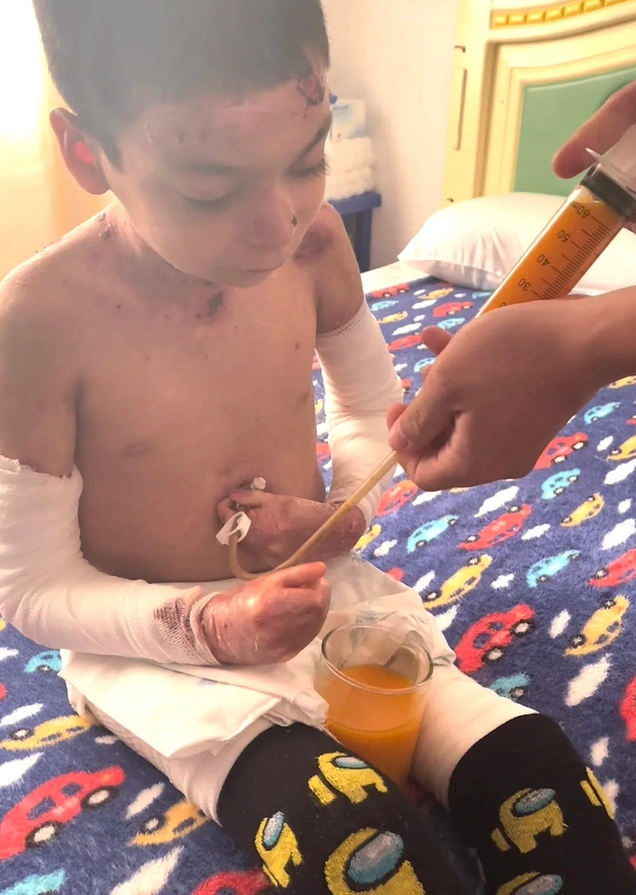 Jesus receiving nutritional support during recovery